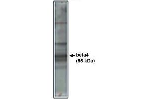 Image no. 1 for anti-Calcium Channel, Voltage-Dependent, beta 4 Subunit (CACNB4) antibody (ABIN265039) (CACNB4 抗体)