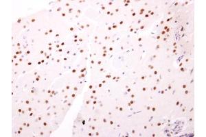 IHC-P Image NAB2 antibody detects NAB2 protein at nucleus on mouse fore brain by immunohistochemical analysis. (NAB2 抗体)