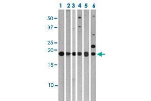 Western blot analysis of Lane 1: 293 cell lysates, Lane 2: Ramos cell lysates, Lane 3: HeLa cell lysates, Lane 4: HepG2 cell lysates, Lane 5: T47D cell lysates, Lane 6: Jurkat cell lysates with MAP1LC3C polyclonal antibody  at 1:1000 dilution. (LC3C 抗体  (AA 1-30))