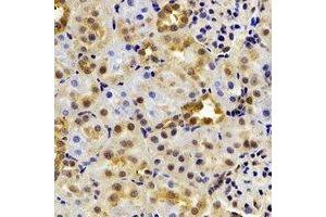 Immunohistochemical analysis of HIWI2 staining in rat kidney formalin fixed paraffin embedded tissue section. (PIWIL4 抗体)