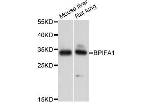 Western blot analysis of extracts of various cell lines, using BPIFA1 antibody. (BPIFA1 抗体)