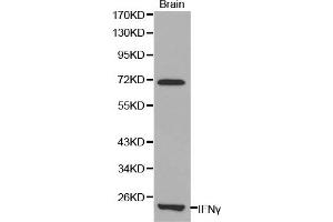 Western blot analysis of mouse brain cell lysate using IFNG antibody. (Interferon gamma 抗体)