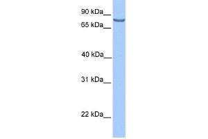 WB Suggested Anti-LCA5 Antibody Titration: 0. (LCA5 抗体  (N-Term))