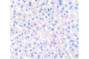 IHC-P analysis of Mouse Liver Tissue, with DAB staining. (ITIH5 抗体  (AA 569-737))