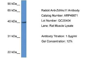 Western Blotting (WB) image for anti-Zinc Finger, DHHC-Type Containing 11 (ZDHHC11) (Middle Region) antibody (ABIN2783945) (ZDHHC11 抗体  (Middle Region))