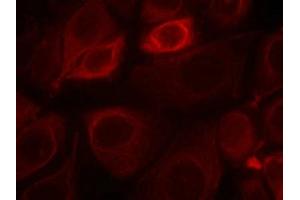 Immunofluorescence staining of methanol-fixed MCF7 cells using Her3/ErbB3(phospho-Tyr1328) Antibody.