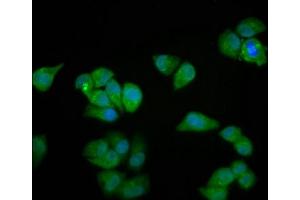 Immunofluorescence staining of Hela cells with ABIN7160664 at 1:100, counter-stained with DAPI. (MYOZ2 抗体  (AA 90-180))