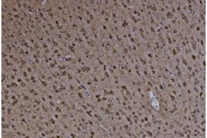 IHC analysis of FABP-1/GOT2 using anti-FABP-1/GOT2 antibody (ABIN7601426). (GOT2 抗体  (AA 35-430))