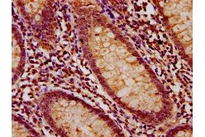 IHC image of ABIN7158363 diluted at 1:200 and staining in paraffin-embedded human appendix tissue performed on a Leica BondTM system. (LMO7 抗体  (AA 1301-1465))