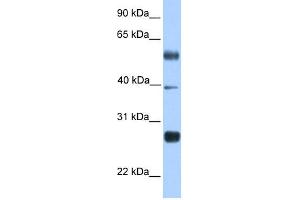 WB Suggested Anti-MXD3 Antibody Titration:  0. (MXD3 抗体  (N-Term))