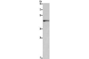 Western Blotting (WB) image for anti-Interleukin 5 Receptor, alpha (IL5RA) antibody (ABIN5549967) (IL5RA 抗体)