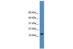 Western Blot showing SLPI antibody used at a concentration of 1-2 ug/ml to detect its target protein. (SLPI 抗体  (N-Term))