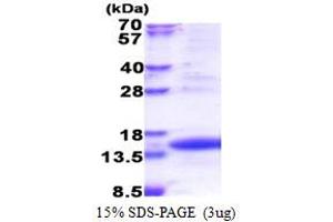 TIMM8A/DDP Protein (AA 1-97) (His tag)