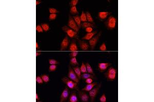 Immunofluorescence analysis of HeLa cells using RBFOX3 antibody (ABIN1874561) at dilution of 1:100. (NeuN 抗体)