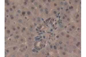 Detection of CD2AP in Rat Liver Tissue using Polyclonal Antibody to CD2 Associated Protein (CD2AP)