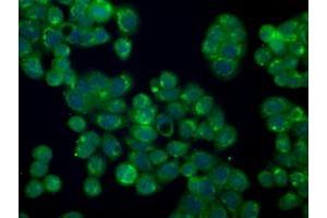 Immunofluorescent staining of HT29 cells using anti-SILV mouse monoclonal antibody (ABIN2452228). (Melanoma gp100 抗体)