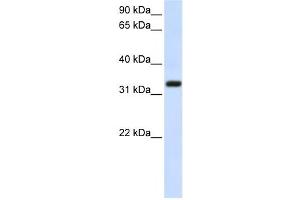 Western Blotting (WB) image for anti-Transmembrane Protein 66 (TMEM66) antibody (ABIN2459079)