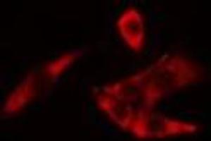 ABIN6275087 staining LOVO cells by IF/ICC.