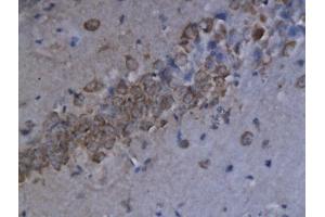 Formalin-fixed and paraffin embedded human spleen labeled with Anti-CXCL9/MIG Polyclonal Antibody, Unconjugated (ABIN741930) at 1:200 followed by conjugation to the secondary antibody and DAB staining. (CXCL9 抗体  (AA 23-125))