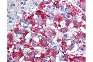 Anti-PARK2 antibody IHC of human adrenal.