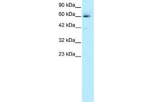 WB Suggested Anti-HCLS1 Antibody Titration: 0.
