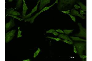 Immunofluorescence of monoclonal antibody to TNFRSF21 on HeLa cell. (TNFRSF21 抗体  (AA 1-472))