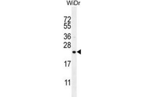 Western Blotting (WB) image for anti-Family with Sequence Similarity 237 Member A (FAM237A) antibody (ABIN3004576)