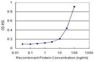 Sandwich ELISA detection sensitivity ranging from 3 ng/mL to 100 ng/mL. (ACAT2 (人) Matched Antibody Pair)