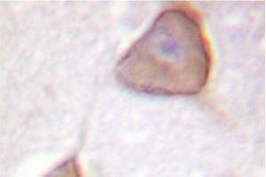 Image no. 1 for anti-Adducin 1 (Alpha) (ADD1) antibody (ABIN265301)