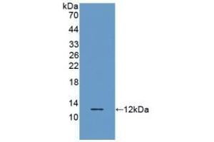 Detection of Recombinant RANTES, Porcine using Polyclonal Antibody to Regulated On Activation In Normal T-Cell Expressed And Secreted (RANTES) (CCL5 抗体  (AA 24-91))