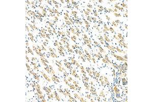 Immunohistochemistry analysis of paraffin-embedded mouse fetal rat using GBA (ABIN7074062) at dilution of 1: 2000 (GBA 抗体)
