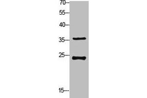 Western Blot analysis of customer's (cat sample) using Ribosomal Protein S4X Polyclonal Antibody (RPS4X 抗体  (Internal Region))