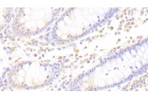 Detection of APBB1IP in Human Colon Tissue using Polyclonal Antibody to Amyloid Beta Precursor Protein Binding B1 Interacting Protein (APBB1IP) (Amyloid beta (A4) Precursor Protein-Binding, Family B, Member 1 Interacting Protein (APBB1IP) (AA 188-421) 抗体)