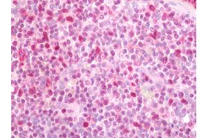 Immunohistochemistry (Paraffin-embedded Sections) (IHC (p)) image for anti-Spleen Focus Forming Virus (SFFV) Proviral Integration Oncogene Spi1 (SPI1) antibody (FITC) (ABIN2572371)