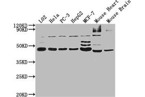 Western Blotting (WB) image for anti-RNA-Binding Protein NOB1 (NOB1) (AA 103-229) antibody (ABIN7168384)