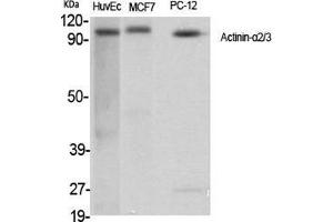 Western Blot (WB) analysis of specific cells using Actinin-alpha2/3 Polyclonal Antibody. (ACTN2/3 抗体  (N-Term))