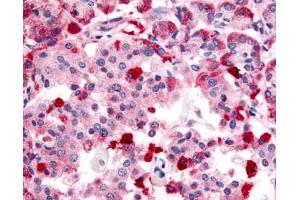 Immunohistochemistry (IHC) image for anti-Transient Receptor Potential Cation Channel, Subfamily M, Member 4 (TRPM4) (Internal Region) antibody (ABIN1049433)