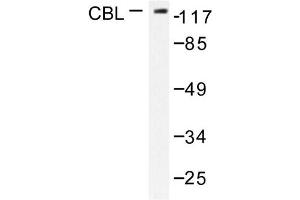 Image no. 1 for anti-Cas-Br-M (Murine) Ecotropic Retroviral Transforming Sequence (CBL) antibody (ABIN271926) (CBL 抗体)