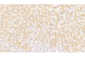 Detection of PSA in Human Liver Tissue using Polyclonal Antibody to Puromycin Sensitive Aminopeptidase (PSA) (NPEPPS 抗体  (AA 584-793))