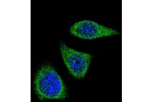Confocal iunofluorescent analysis of P7 Antibody (Center) (ABIN390152 and ABIN2840651) with 293 cell followed by Alexa Fluor® 488-conjugated goat anti-rabbit lgG (green). (MMP7 抗体  (AA 117-146))
