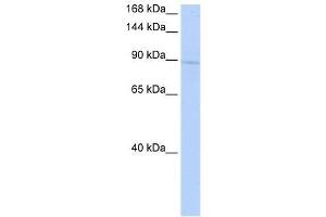 Western Blot showing KIF20A antibody used at a concentration of 1 ug/ml against 721_B Cell Lysate