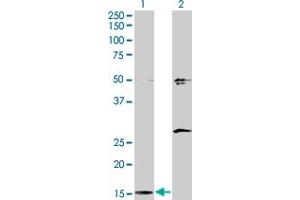 Western Blot analysis of AP2S1 expression in transfected 293T cell line by AP2S1 monoclonal antibody (M01), clone 3E4. (AP2S1 抗体  (AA 1-142))