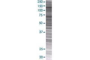 NCKAP1 transfected lysate. (NCKAP1 293T Cell Transient Overexpression Lysate(Denatured))