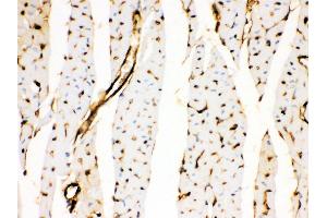 Anti- Annexin A3 Picoband antibody, IHC(P) IHC(P): Rat Cardiac Muscle Tissue (Annexin A3 抗体  (Middle Region))