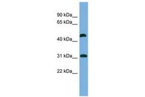 Image no. 1 for anti-CTD (Carboxy-terminal Domain, RNA Polymerase II, Polypeptide A) Small Phosphatase 2 (CTDSP2) (N-Term) antibody (ABIN6743624)
