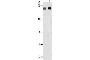 Western Blotting (WB) image for anti-SWI/SNF Related, Matrix Associated, Actin Dependent Regulator of Chromatin, Subfamily A, Member 4 (SMARCA4) antibody (ABIN2431118) (SMARCA4 抗体)