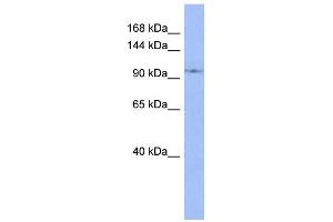 WB Suggested Anti-DDX26B Antibody Titration:  0. (DDX26B 抗体  (N-Term))