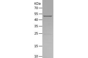 Western Blotting (WB) image for Placenta Growth Factor (PGF) (AA 1-170) protein (His-IF2DI Tag) (ABIN7124457)