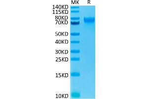 IL15RA Protein (Fc Tag)