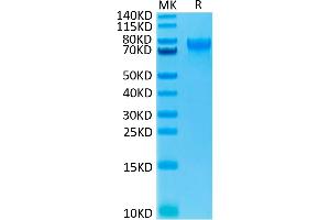 Human IL-15RA on Tris-Bis PAGE under reduced condition. (IL15RA Protein (Fc Tag))